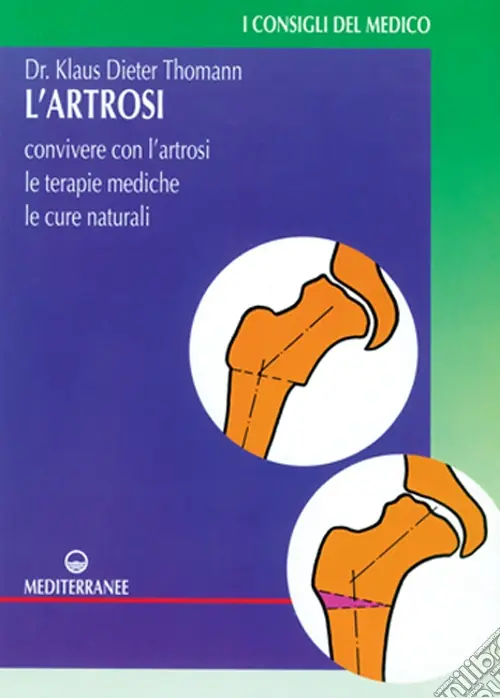 Esclusivo L‘artrosi. Come convivere con l‘artrosi. Le terapie mediche, le cure individuali