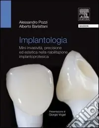 Implantologia. Mini-invasività, precisione ed estetica nella riabilitazione implantoprotesica Compra Oggi Stesso