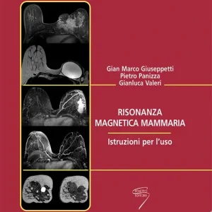 Prezzo Scontato Risonanza magnetica mammaria. Istruzioni per l‘uso