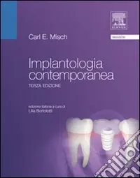 Implantologia contemporanea Offerta Speciale