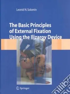 Popolare The basic principles of external skeletal fixation using Ilizarov device